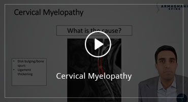 Cervical Myelopathy