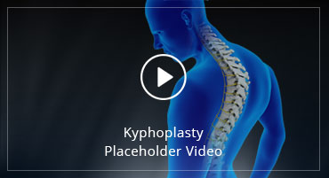 Kyphoplasty