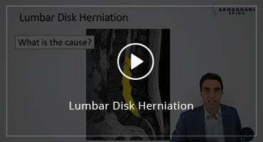 Lumbar Disk Herniation